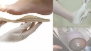 orthotics foot foot casting Oakville orthotics foot casting Oakville